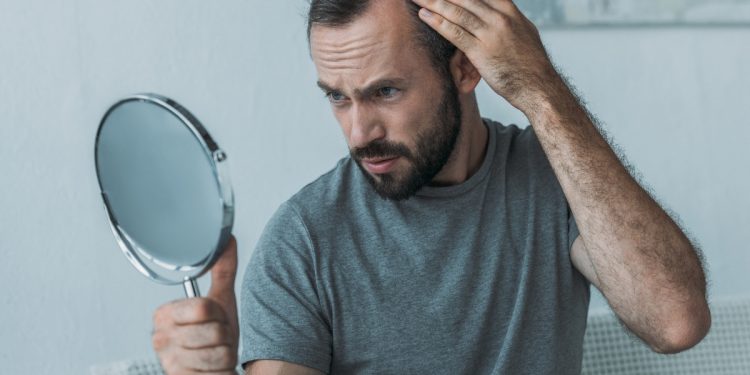 cibi, rimedi e casco laser contro la caduta dei capelli