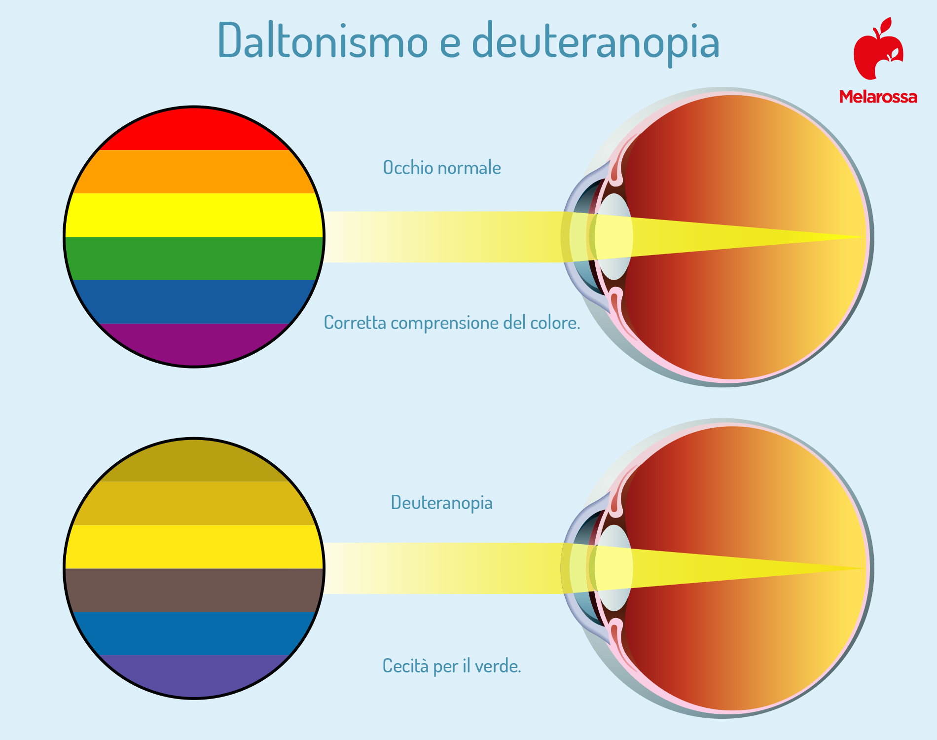 daltonismo e deuteranopia