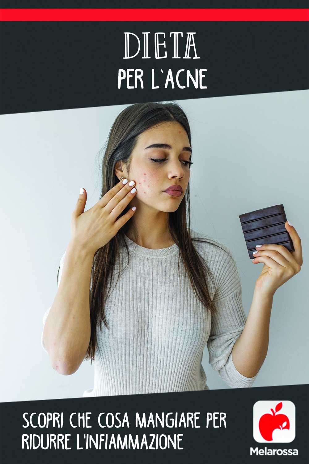 dieta per l'acne: cosa mangiare e cosa evitare