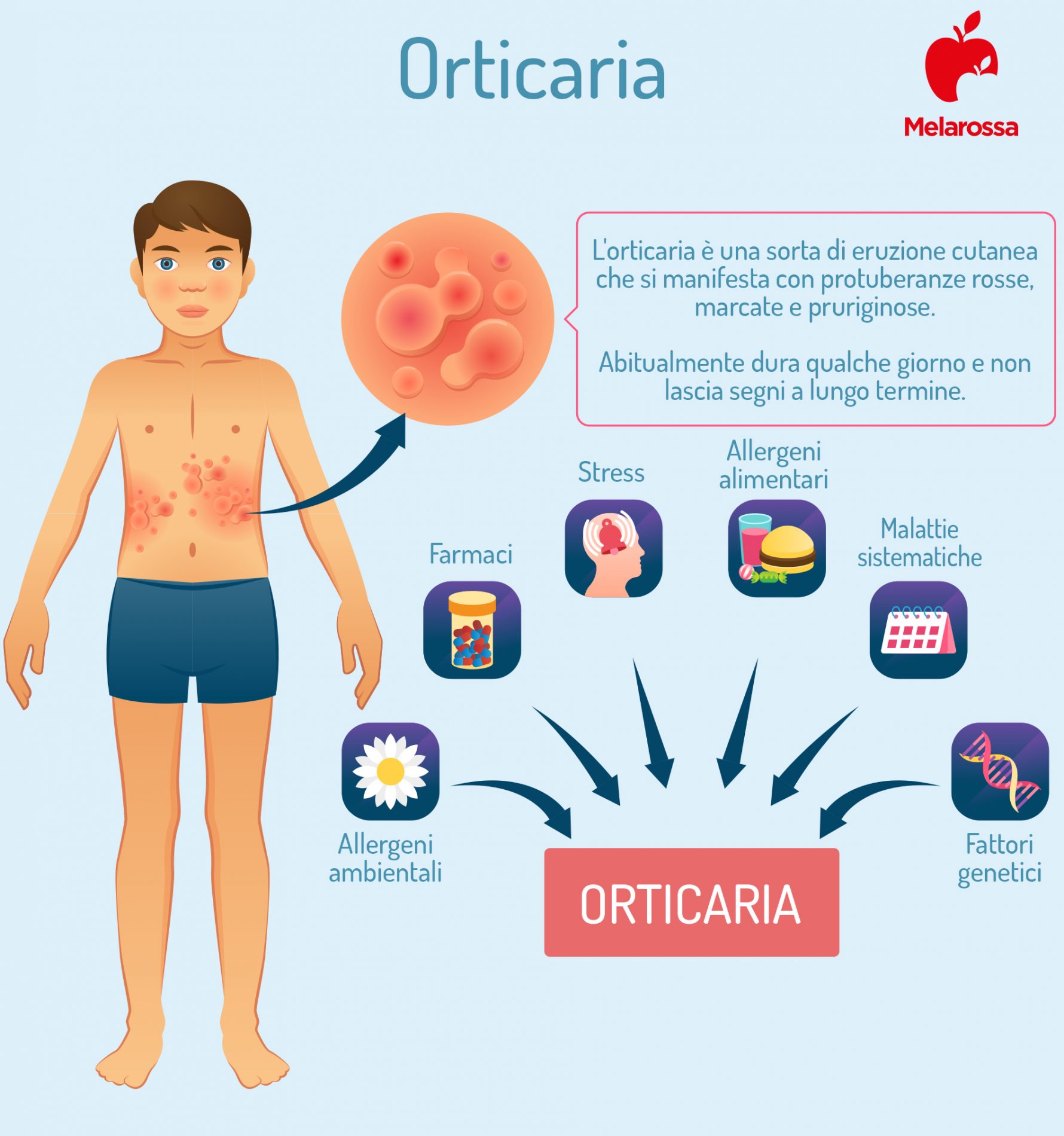 orticaria: cause