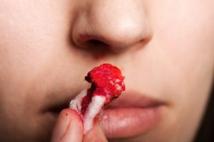 Sangue dal naso o epistassi: che cos’è, cause, sintomi, cure e trattamenti