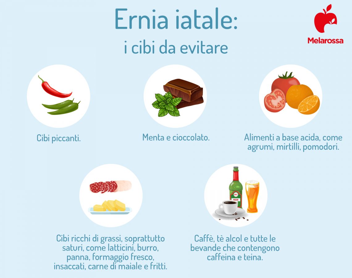 Ernia iatale cos’è, quali sono i sintomi e come si cura Ernia iatale cos’è, quali sono i sintomi e come si cura