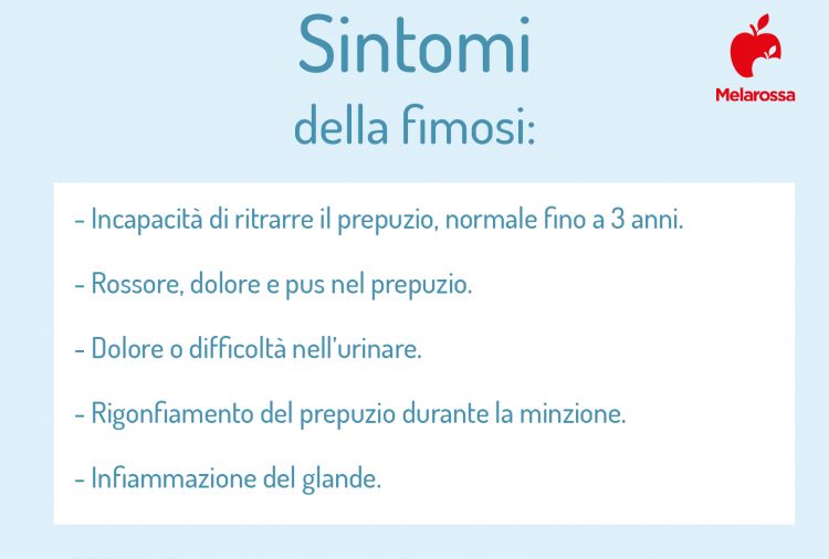 Come Pulire Il Glande Dallo Smegma