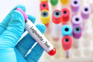 Legionella: cos’è, caratteristiche, contagio, sintomi, cure e prevenzione