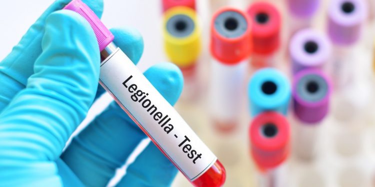 legionella: cos'è, cause, sintomi e cure