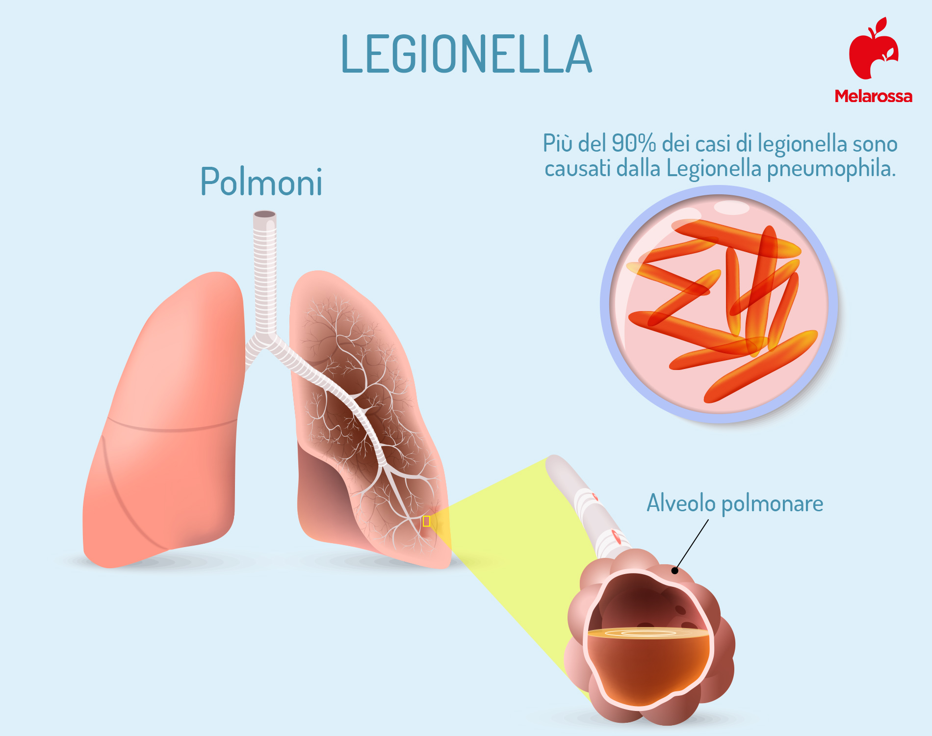 legionella: cos'è