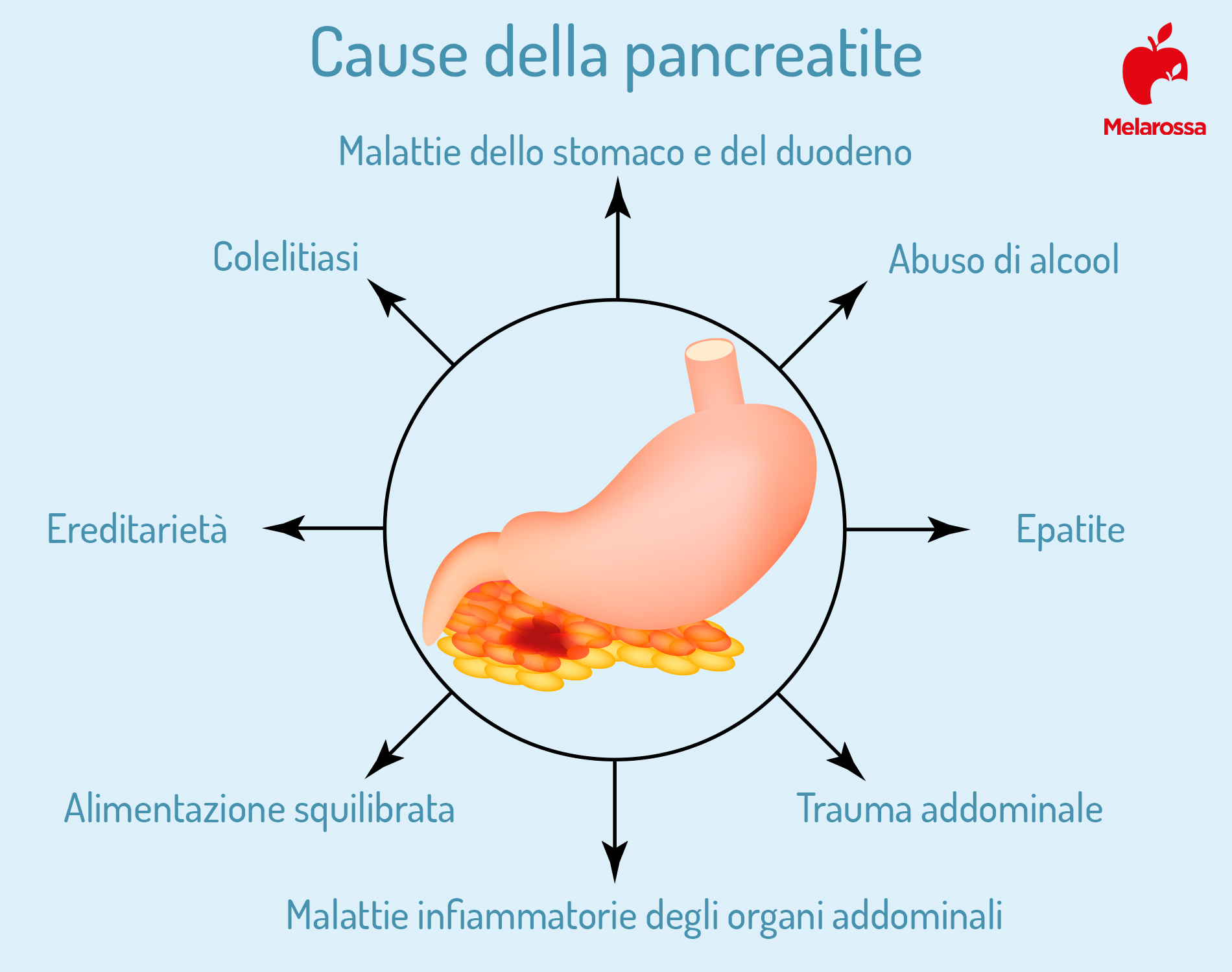 pancreatite cause