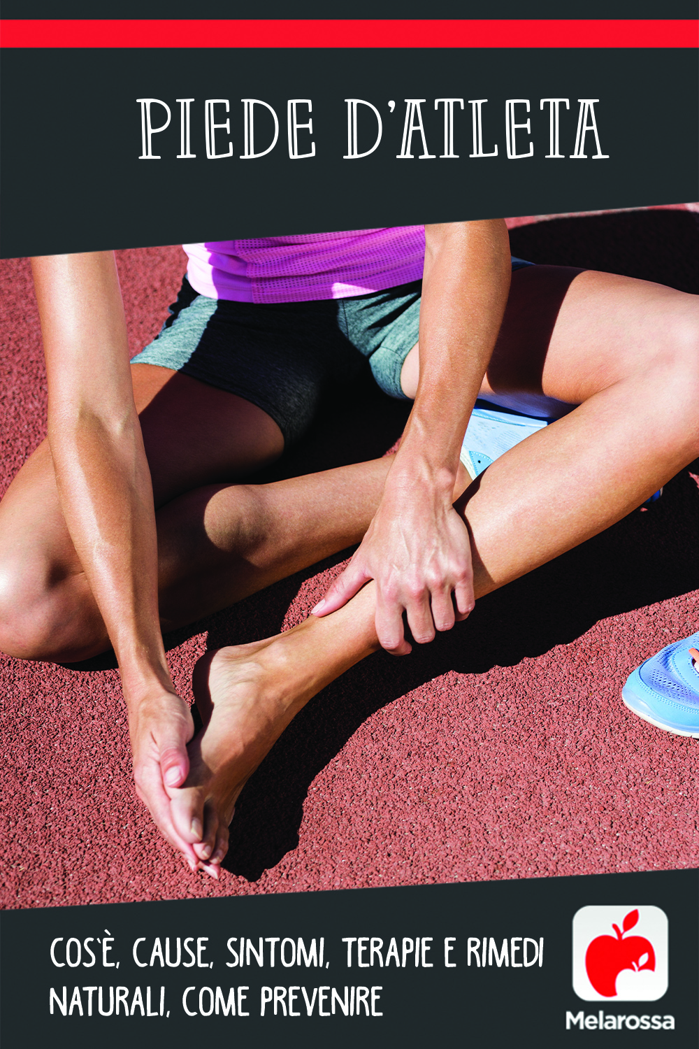 piede d'atleta: cos'è, cause, sintomi e cure 