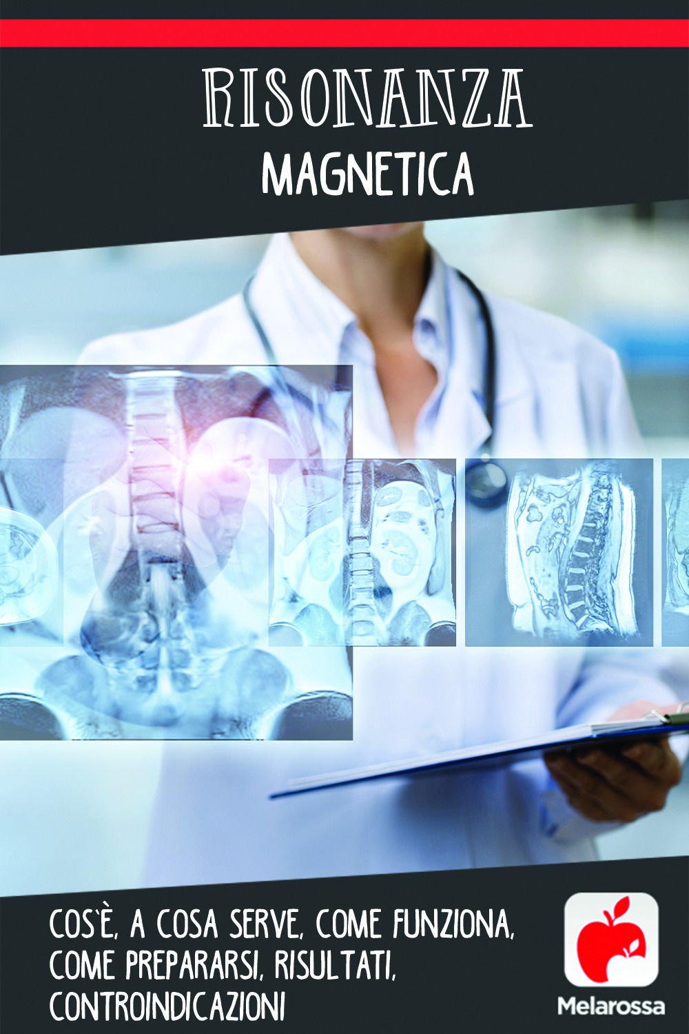 risonanza magnetica: cos'è, a cosa serve, come prepararsi