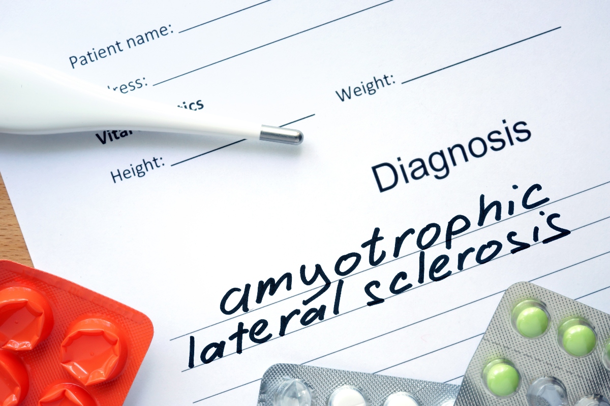 SLA: diagnosi 