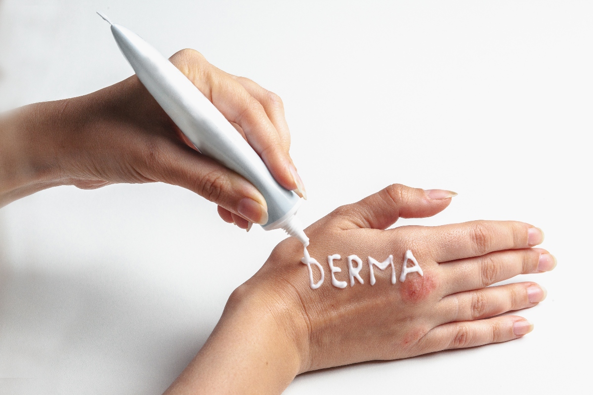 come curare la dermatite da contatto