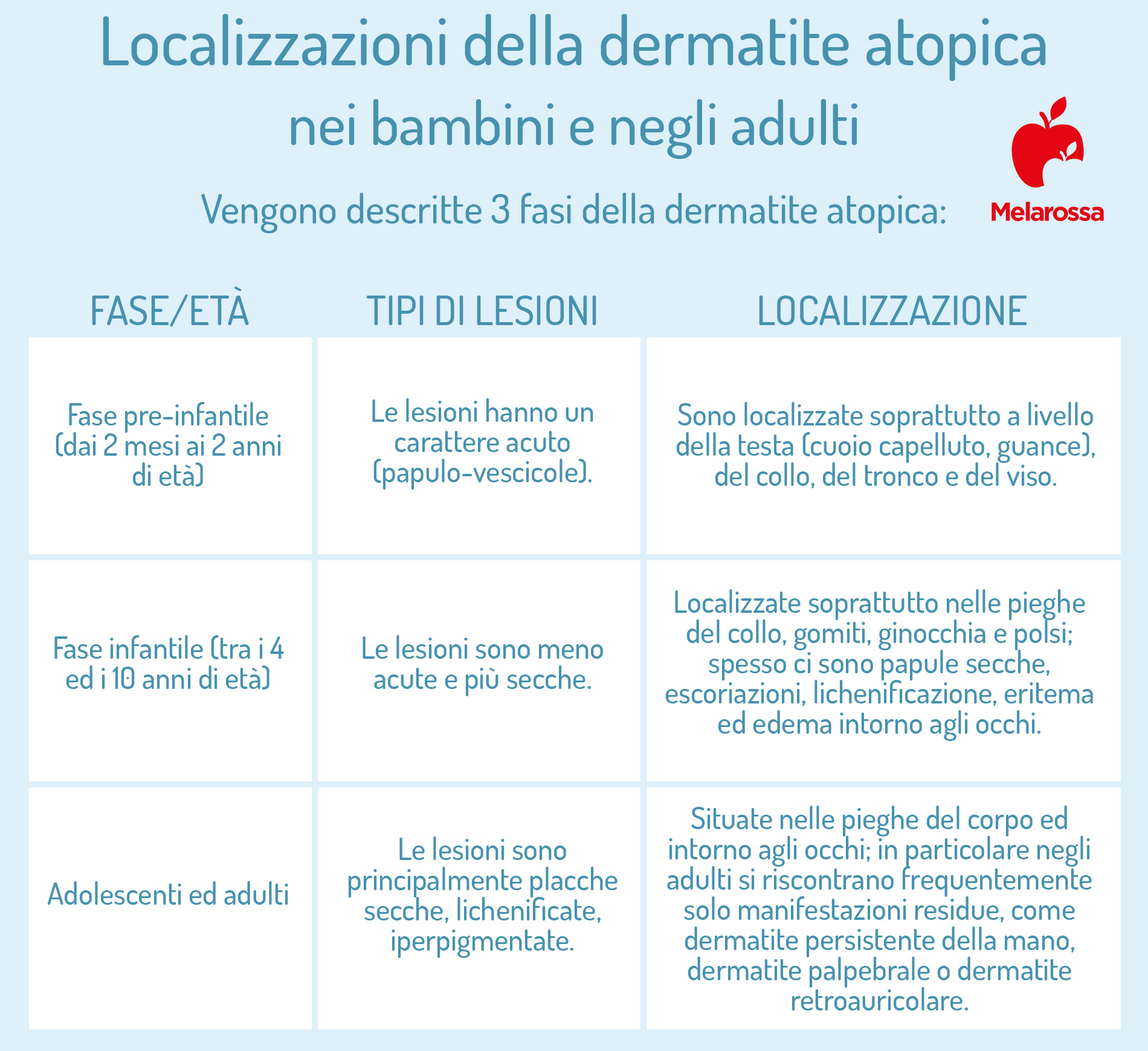 dermatite atopica: localizzazioni