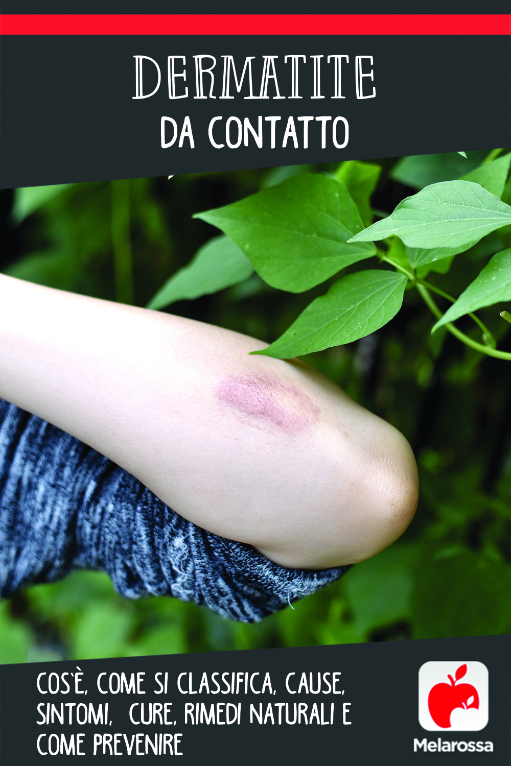 dermatite da contatto: cos'è, cause, sintomi e cure