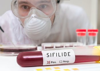 sifilide: cos'è, cause, sintomi e cure