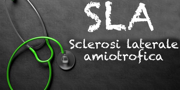 SLA: cos'è, cause, sintomi, diagnosi, decorso