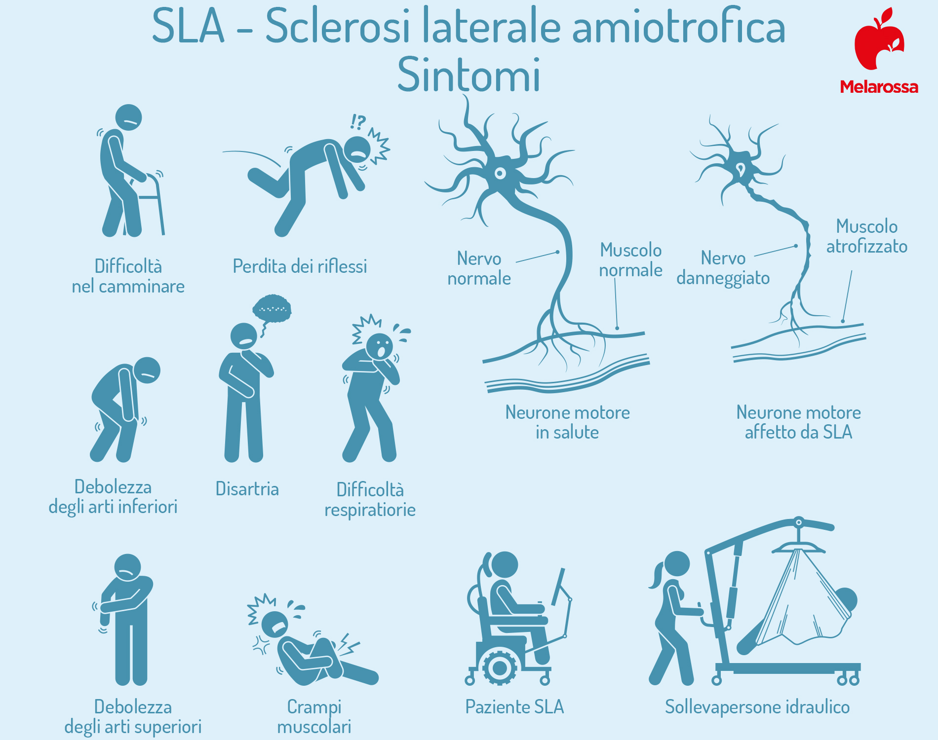 SLA: sintomi