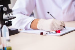 TSH (tireotropina): cos’è, come funziona l’esame, valori normali e cosa fare quando è alto o basso