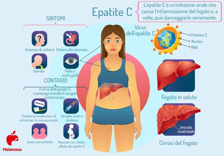 Epatite C cos’è, cause e sintomi, contagio, diagnosi, cure e prevenzione