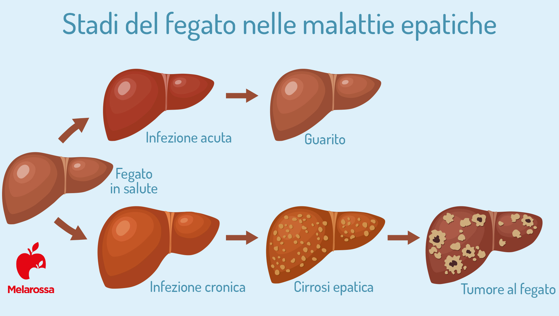 epatite C: fegato