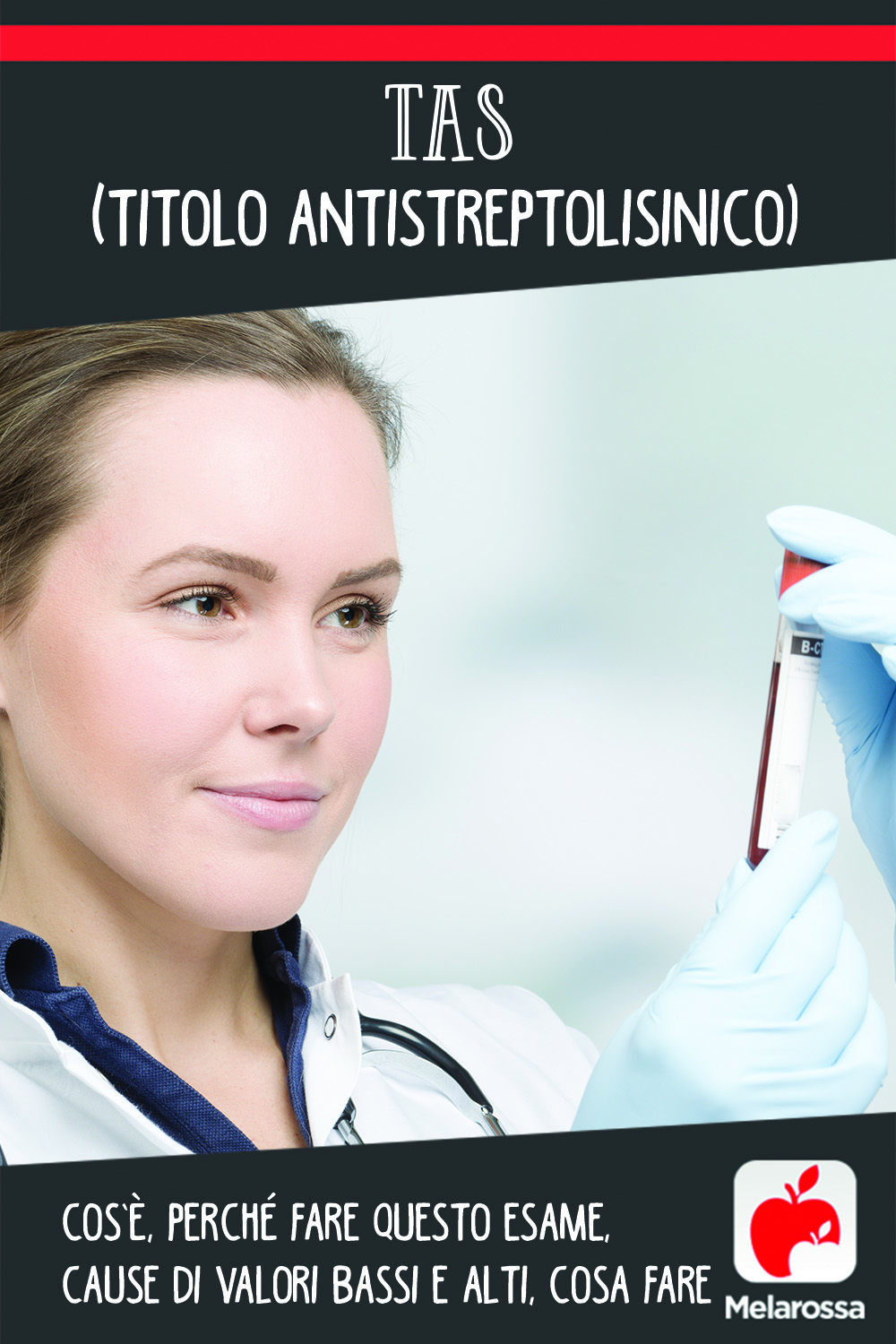 TAS: titolo titolo antistreptolisinico
