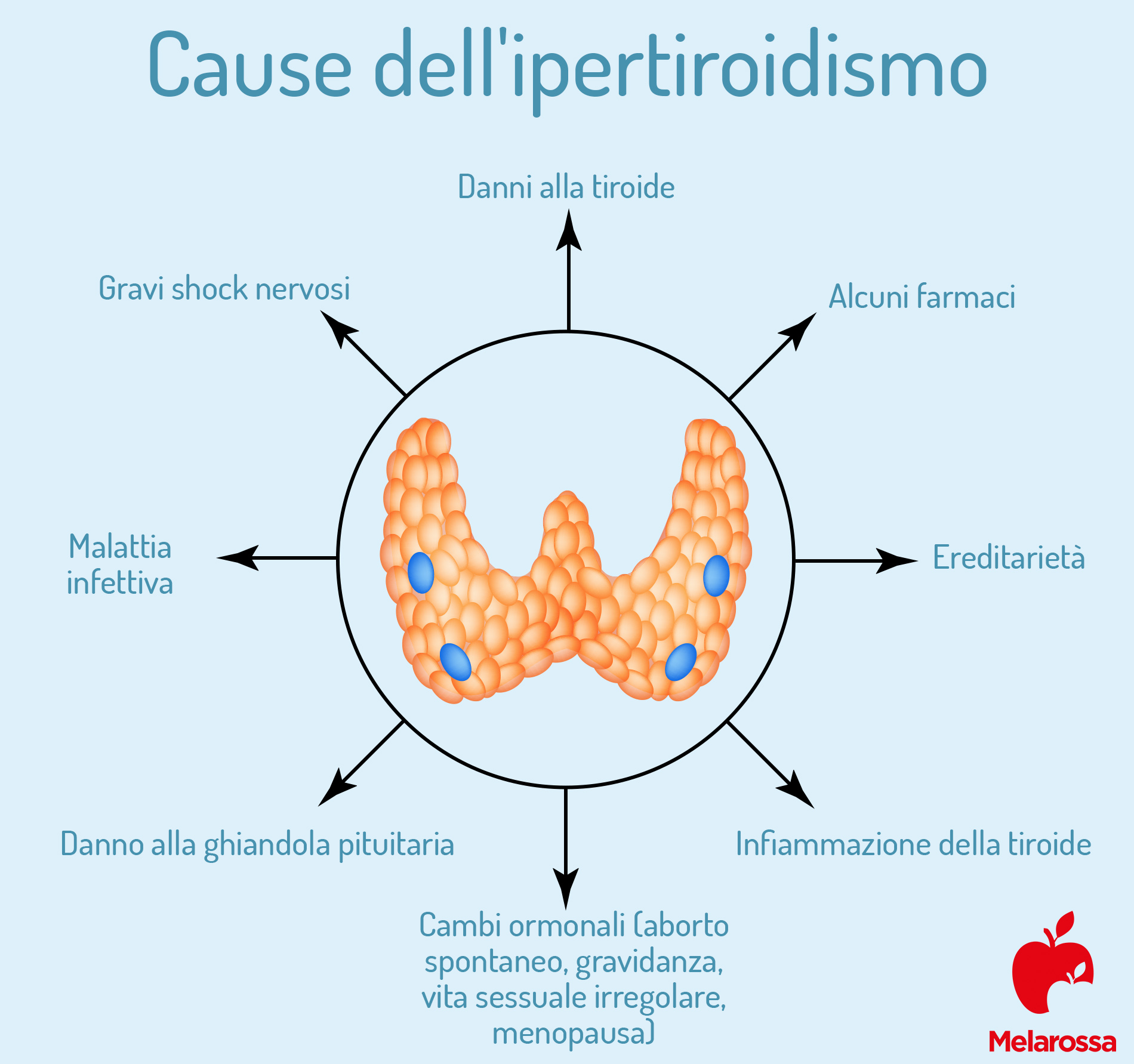 tabella: quale sono le cause dell'ipertiroidismo