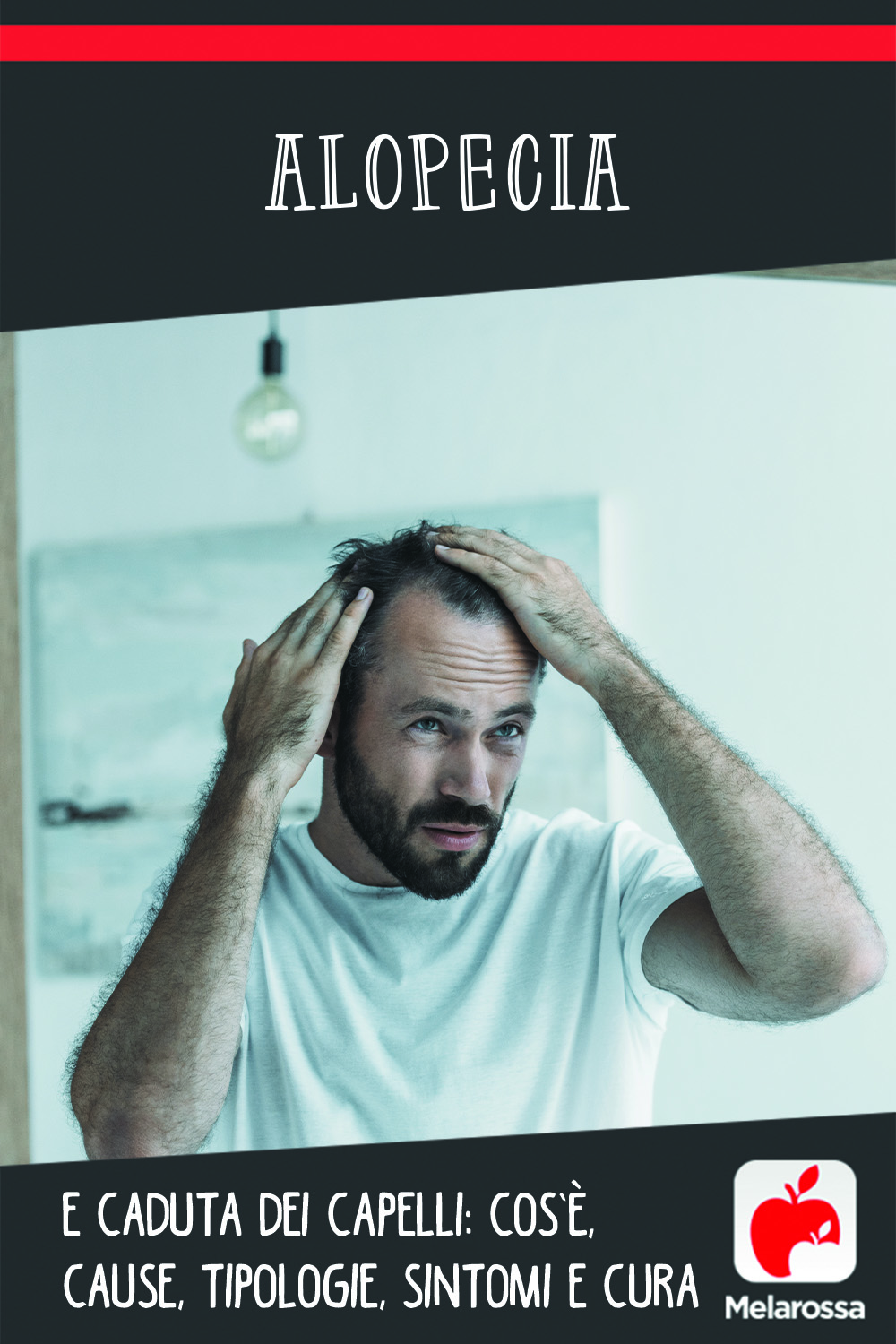 alopecia: cos0è, cause, sintomi e cure