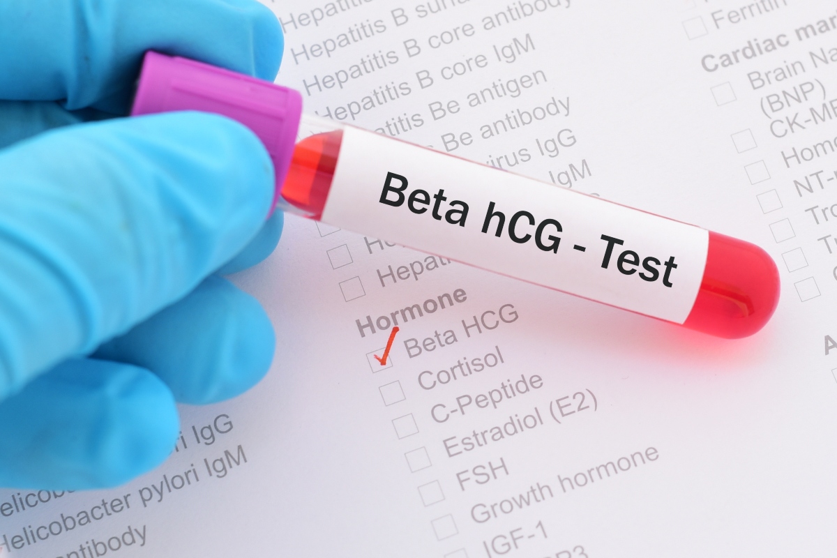 Beta hcg: test 