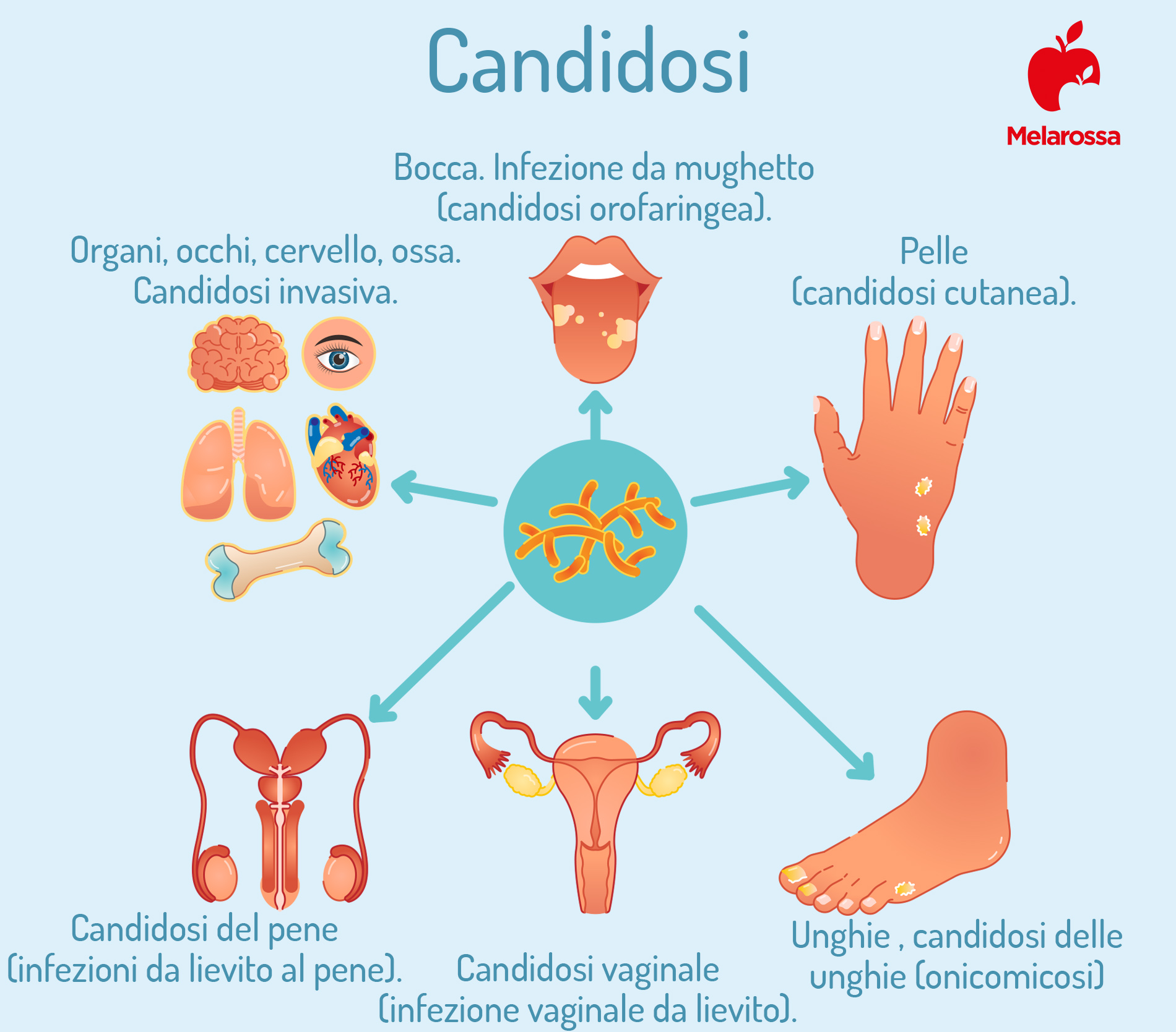 Wings kunst Sige Candida: cos'è, tipologie, cause, sintomi, cure e prevenzione