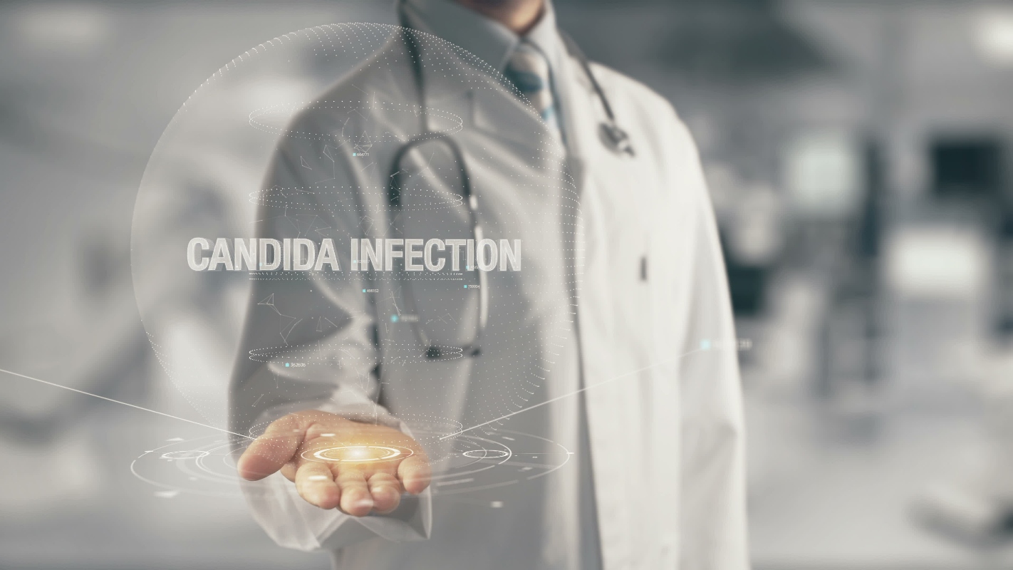 candida: diagnosi