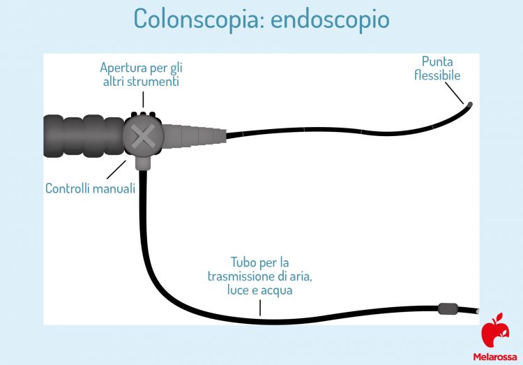Colonscopia: cos’è, procedura, durata e quanto è dolorosa - Melarossa