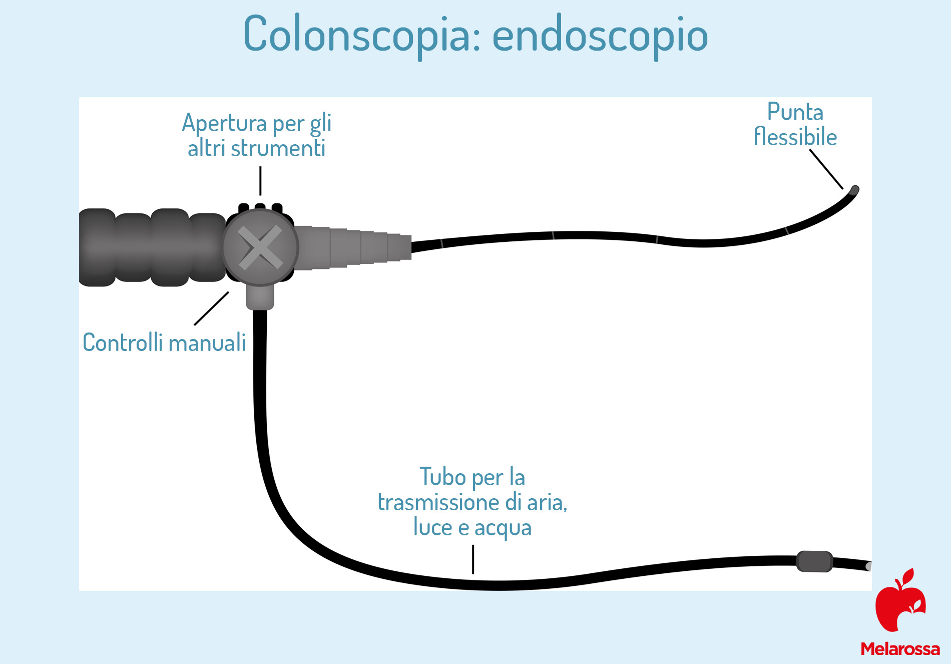 colosnscopia: com'è fatto endoscopio
