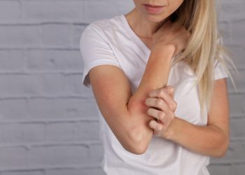 dermatite da stress: cos'è, cause, sintomi, cure e prevenzione