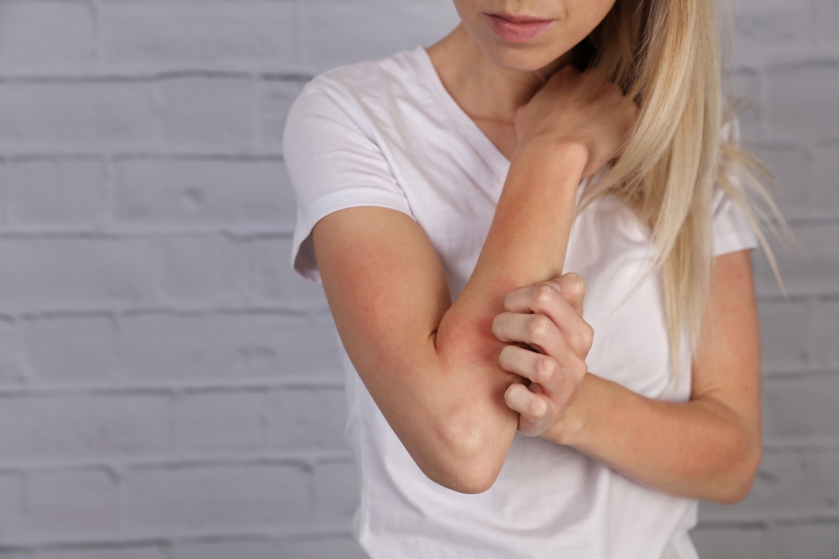 Dermatite Da Stress Cosè Cause Sintomi Rimedi E Cura Prevenzione