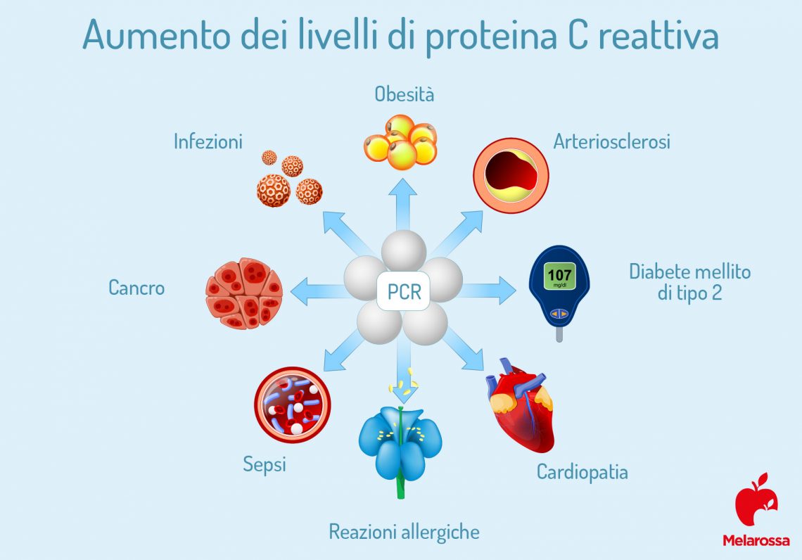 Proteina C reattiva cos’è, perché si