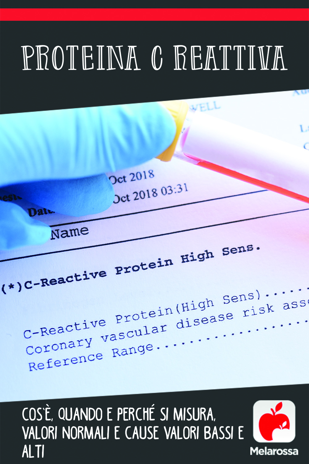 proteina C reattiva: cos'è, perché fare l'esame , valori normali, medi e alti, patologie