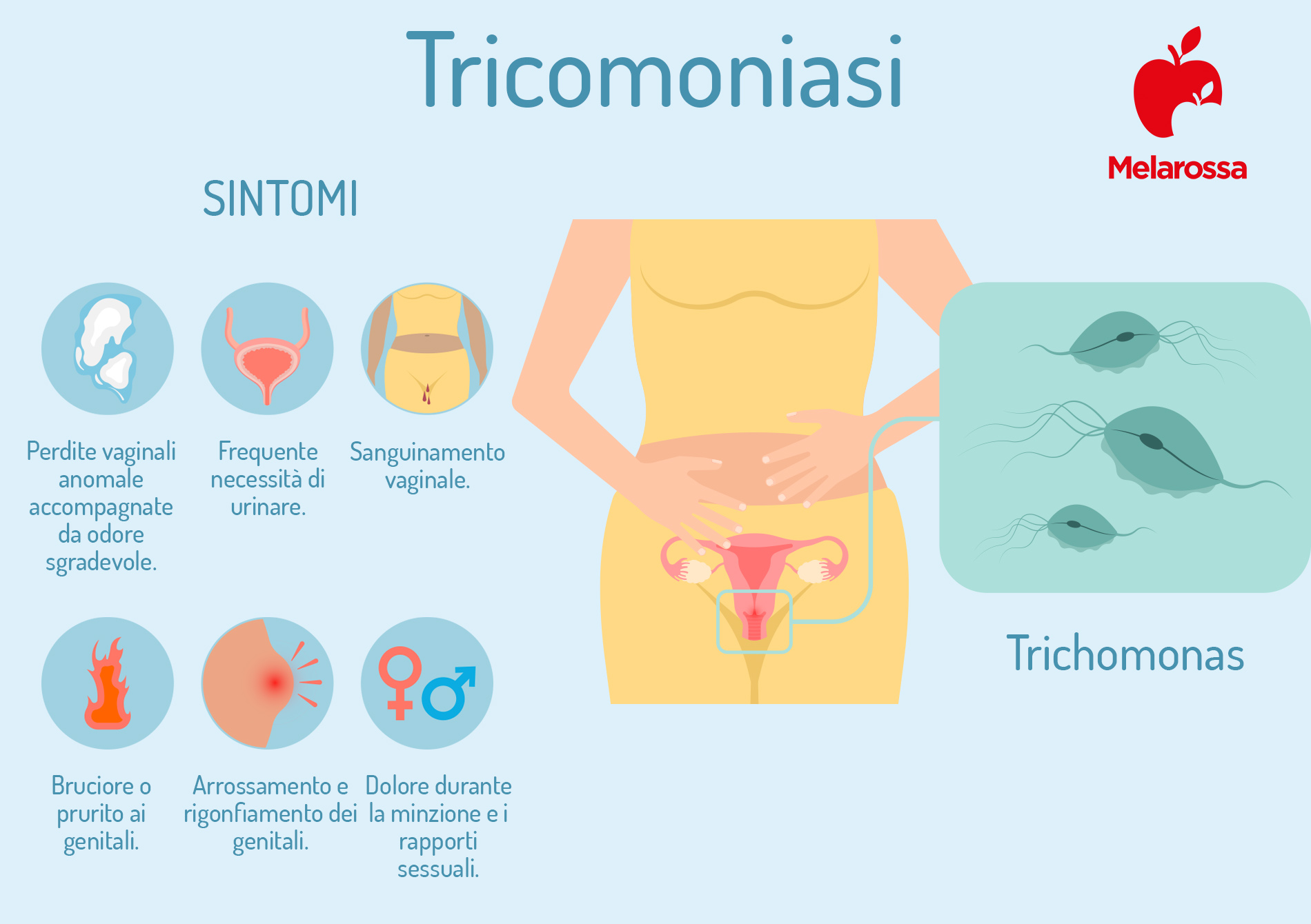 tricomoniasi: sintomi