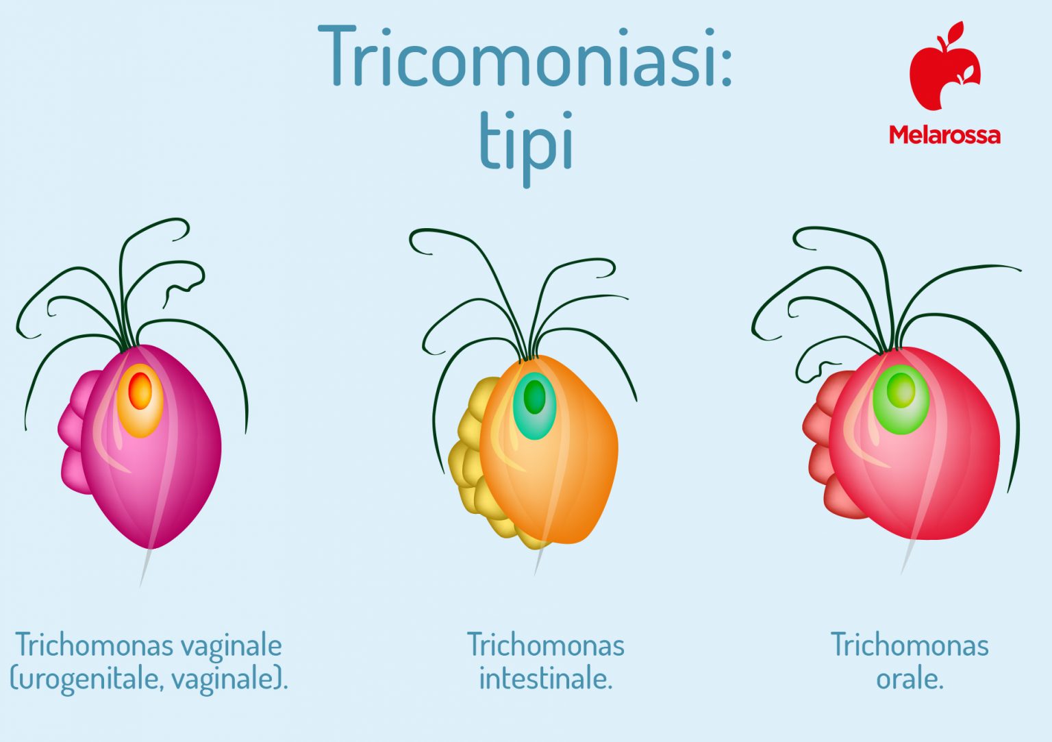 Tricomoniasi: cos’è, cause e sintomi, diagnosi, cura e prevenzione