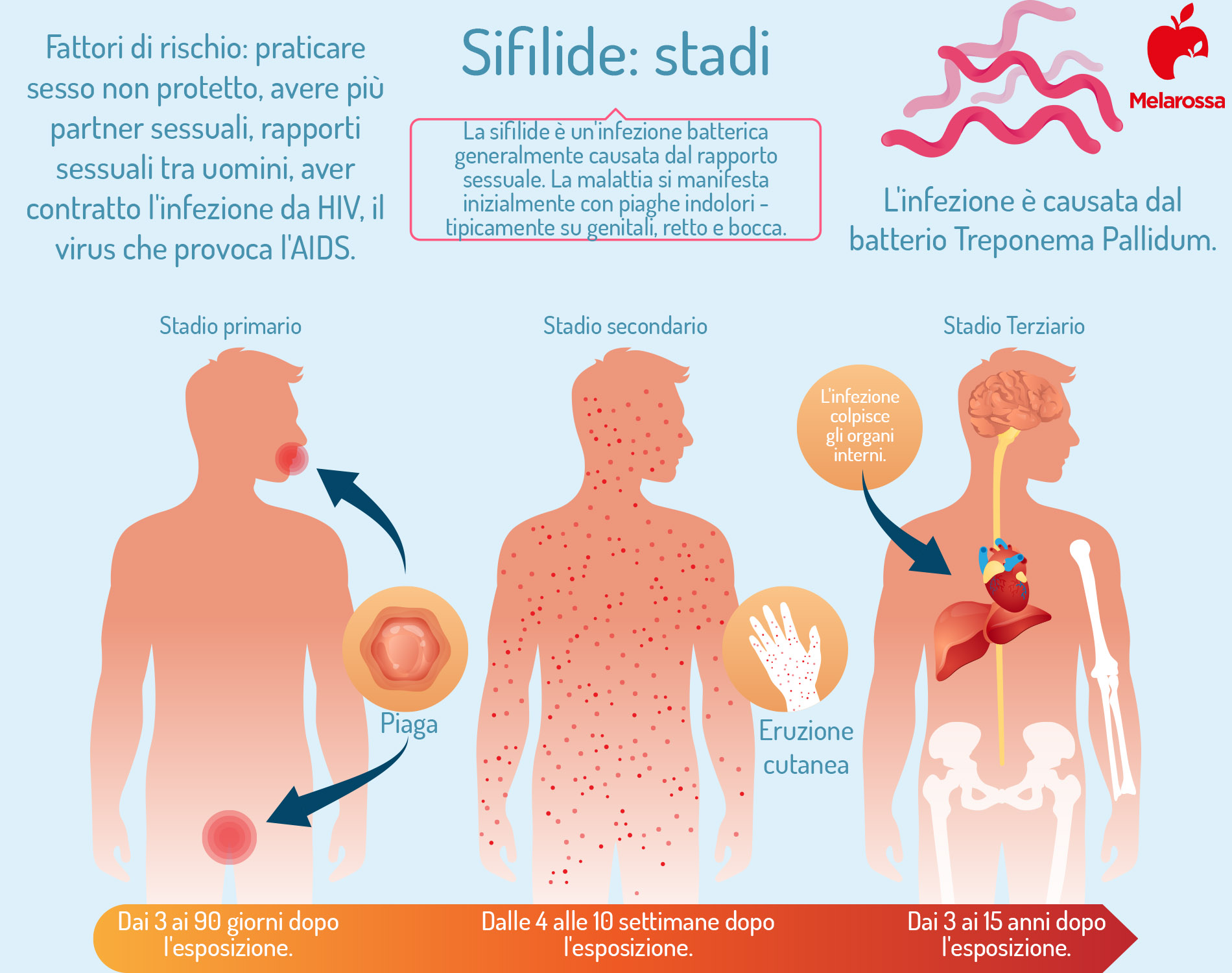 MST:  i stadi della sifilide