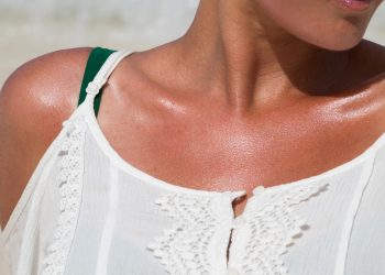 allergia al sole: una donna che presenta del rossore sul collo