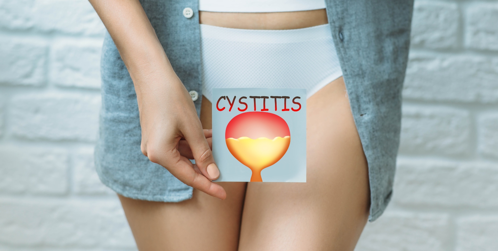 cura cistite: farmaci