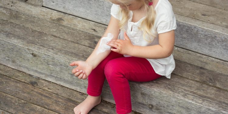 dermatite: cos'è, cause, sintomi, cure e tipi di dermatiti