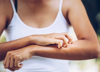 dermatite erpetiforme: cos'è, cause, sintomi, diagnosi e cure