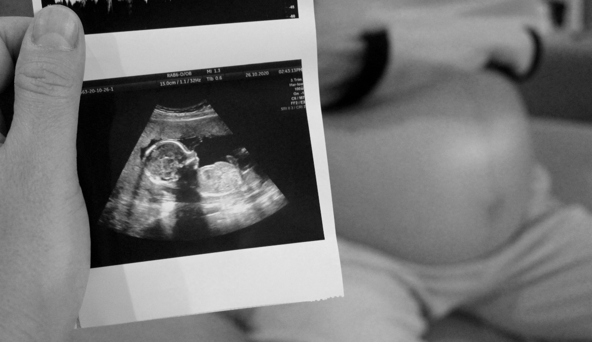 esami in gravidanza: ecografia morfologica 