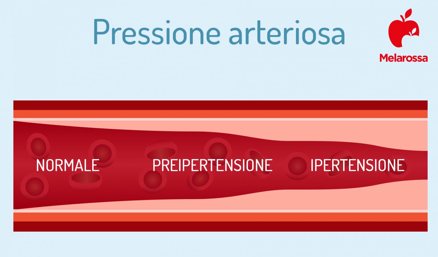 Pressione arteriosa cos’è, valori, come si misura e trattamenti