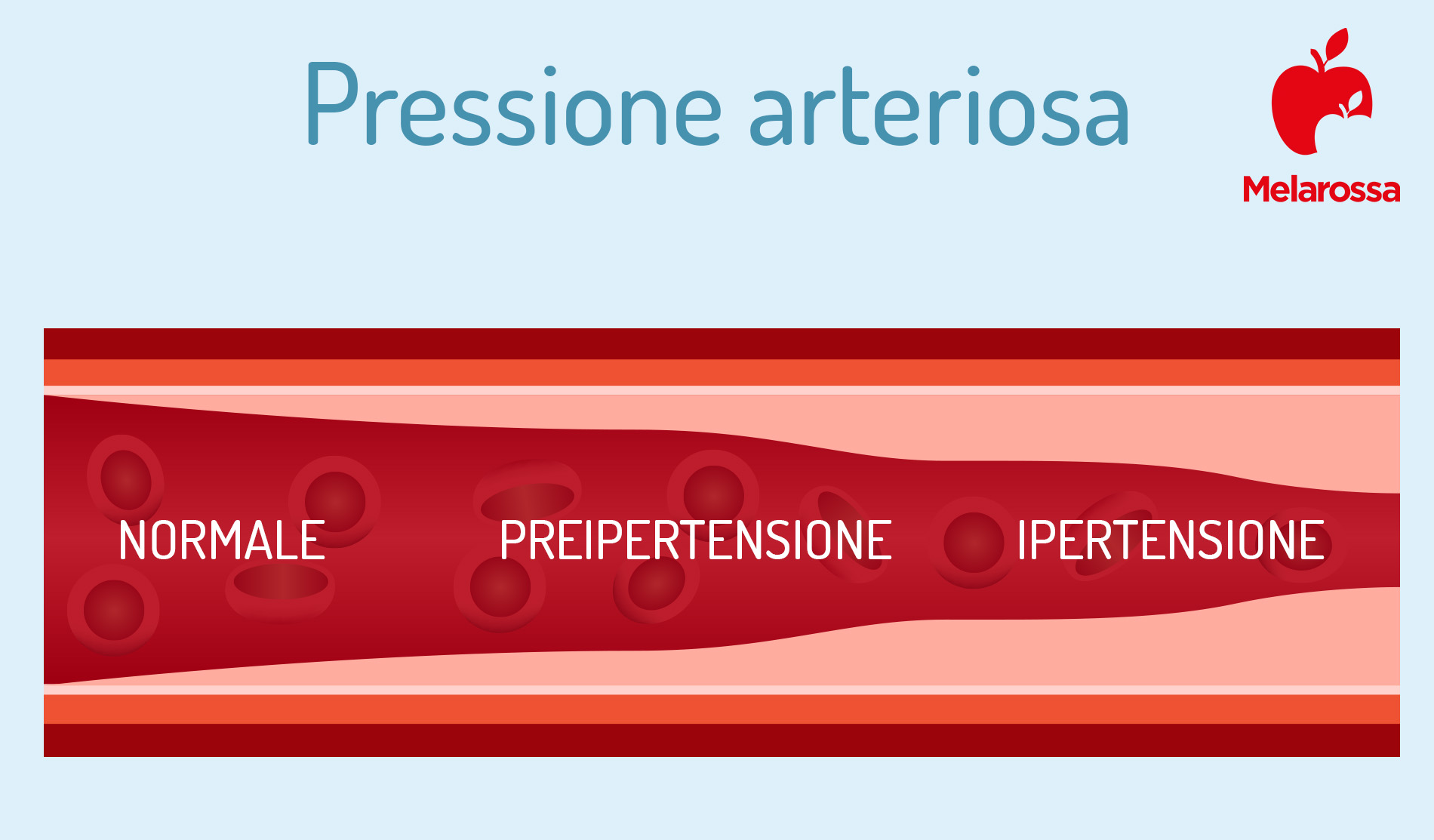 pressione arteriosa: valori 