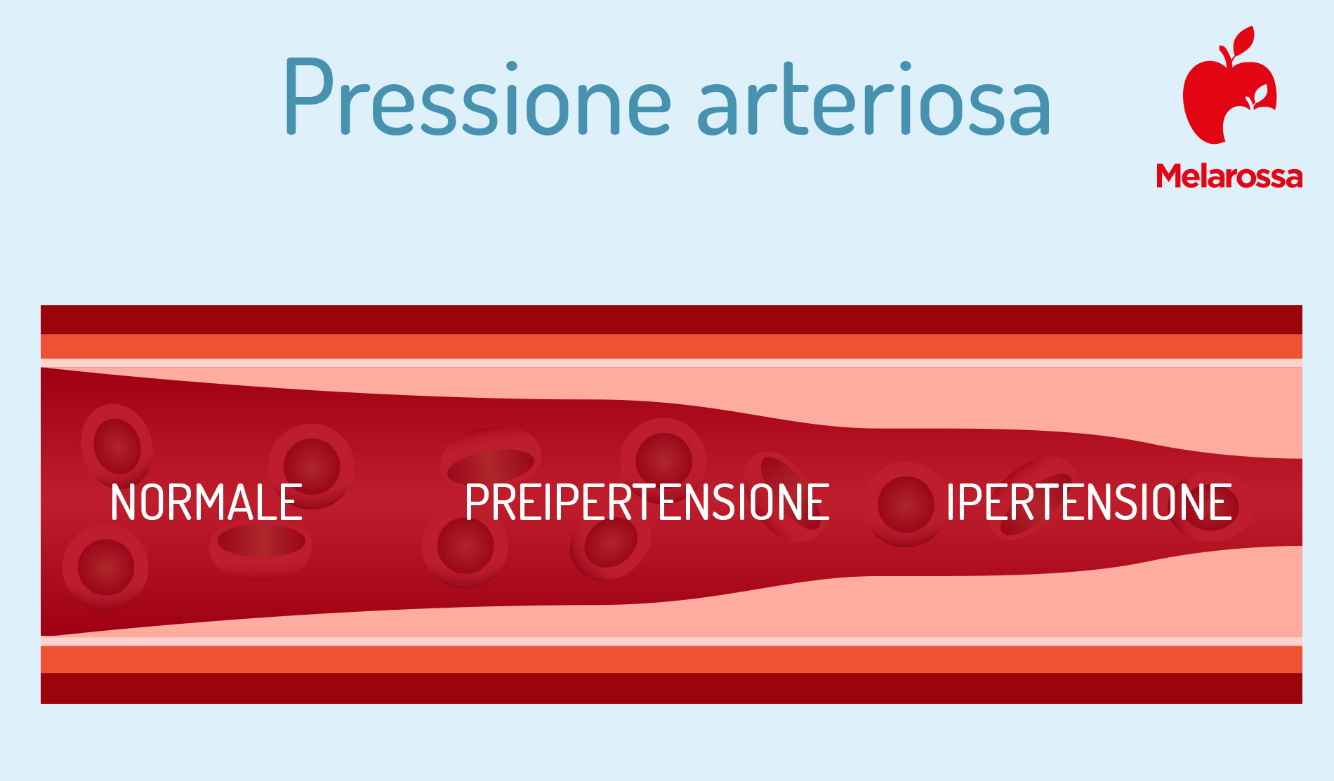 pressione arteriosa: valori
