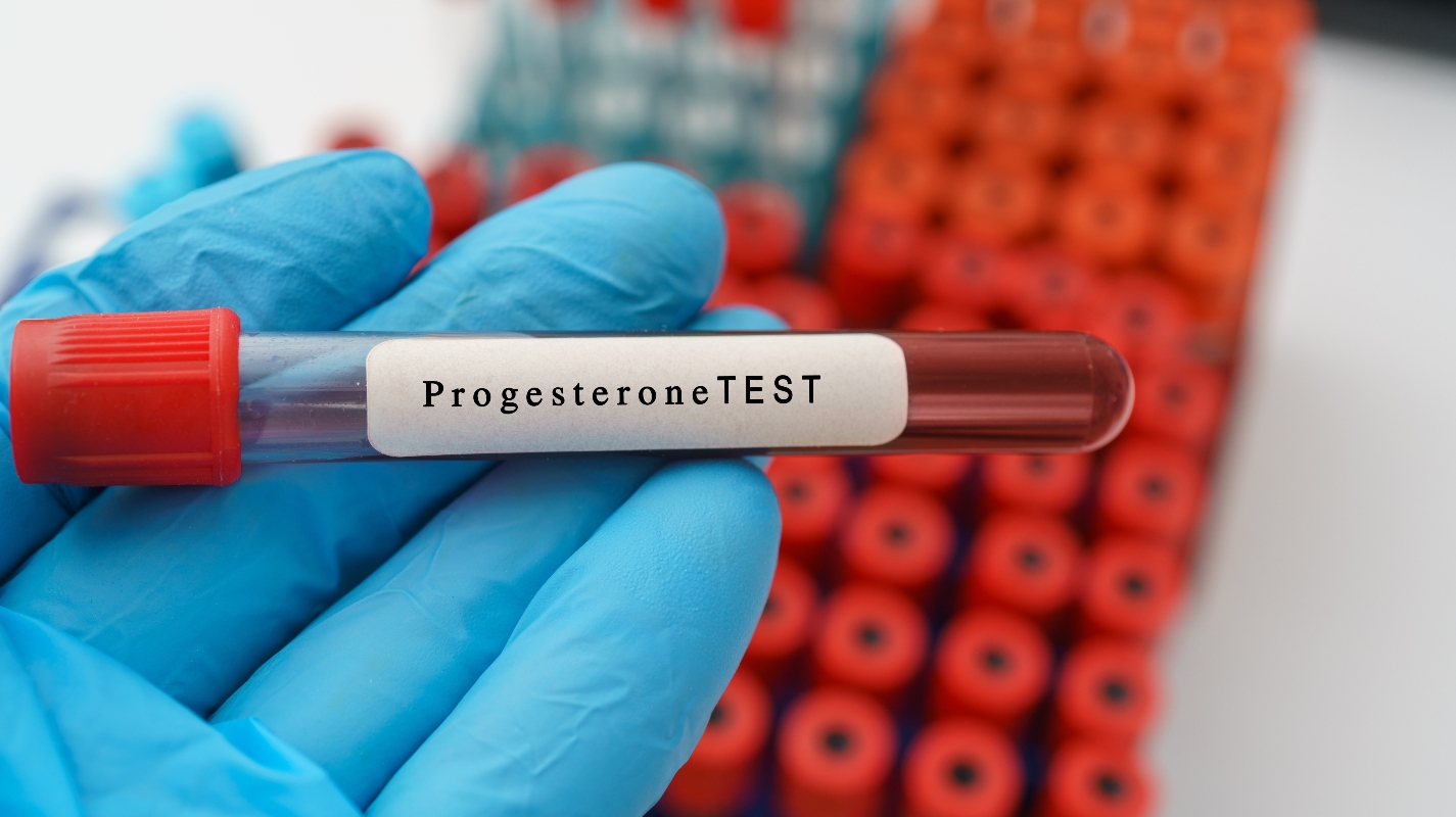 progesterone in gravidanza: a cosa serve fare il test 