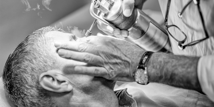 Crioterapia cos e a cosa serve benefici costi risultati