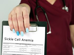 Anemia falciforme: cos’è, cause, sintomi e trattamento