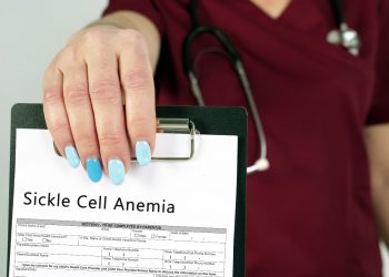 anemia falciforme: cos'è, cause, sintomi, diagnosi e cure